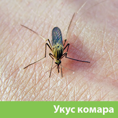 Укусы комаров в Череповце