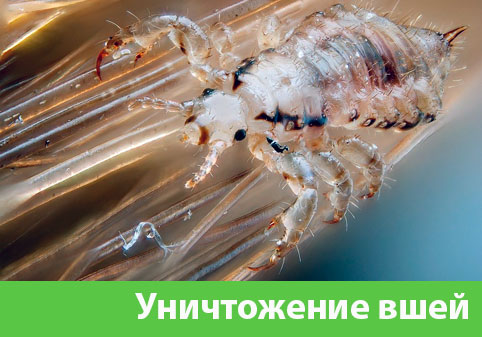Уничтожение вшей в городе Череповец